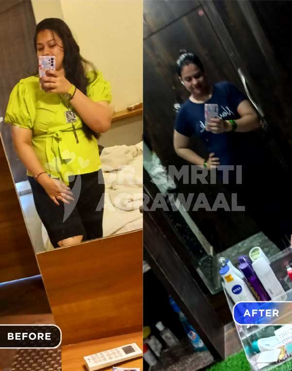 Dr Smriti Agrawaal - Nutritionist and Weight Loss Review - Sonali Sharma loss 13.5 kg in 3 months
